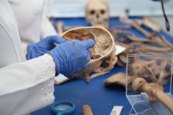 Antropologia Forense do IML identifica corpos e ossadas em avançado estado de decomposição