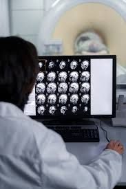 Entenda as promessas do medicamento recém-aprovado para câncer cerebral
