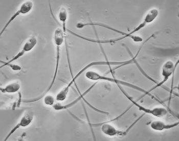 Pesquisa mapeia vírus no sêmen capazes de transmitir doenças