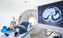 Exame em estudo pode antecipar diagnóstico da esclerose múltipla em 7 anos